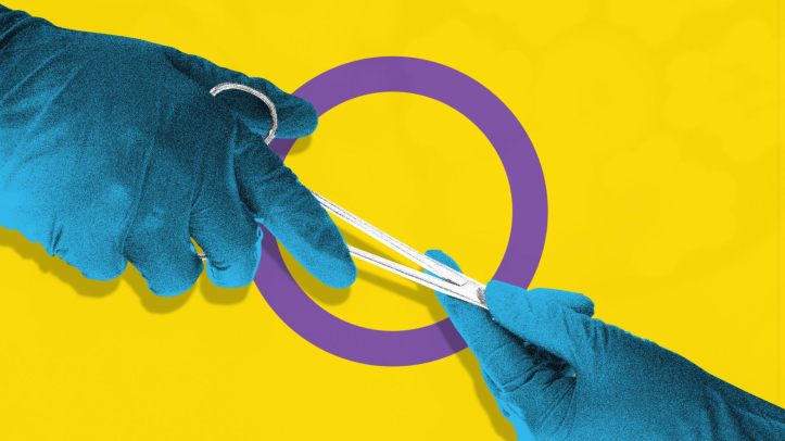 intersex Elizabeth Brockway